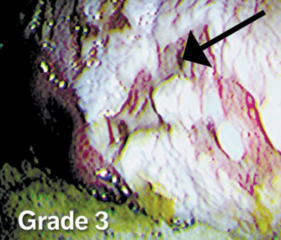Equine Stomach Ulcers: A Threat to Horses of All Ages promo image