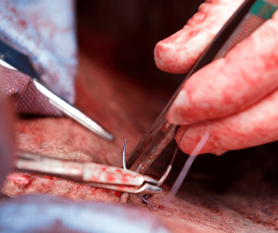 Leg Wounds: Does He Need Stitches? promo image