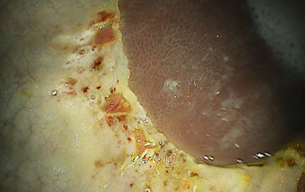 Watch to Win and Learn About Equine Stomach Ulcers promo image