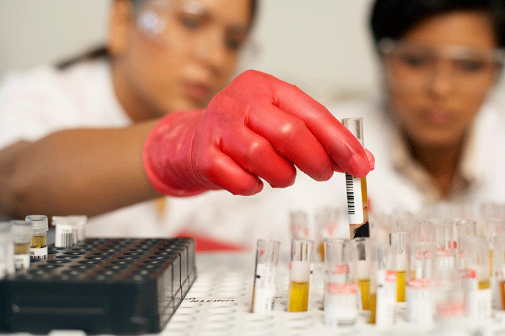 What Antibody Titers Can Tell Us promo image